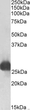Cyb5r3 Antibody