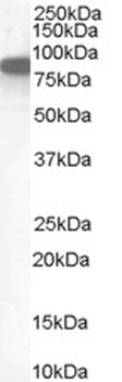 SH2D1A Antibody