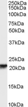 NBEA Antibody