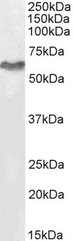 TRIM55 Antibody