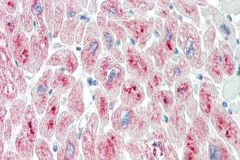 TRIM55 Antibody