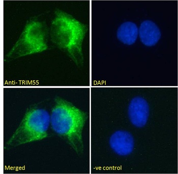 TRIM55 Antibody