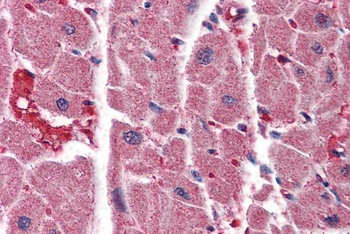 ITPR2 Antibody