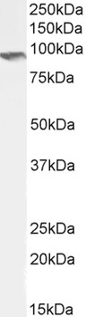 IFT88 Antibody