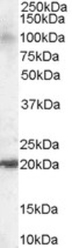 ARL6IP5 Antibody