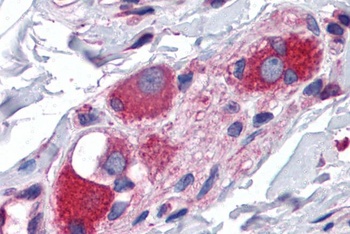 ARL6IP5 Antibody