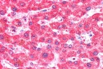 IFT74 Antibody