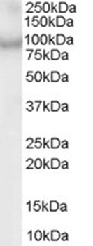 ACAP2 Antibody