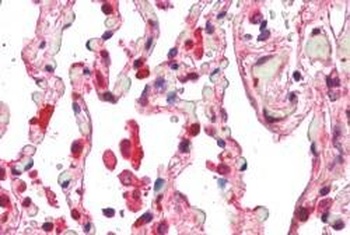 ACAP2 Antibody