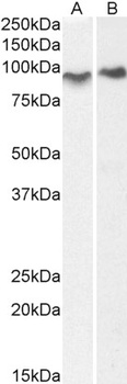 ACAP2 Antibody