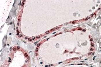 PPP2R1A Antibody