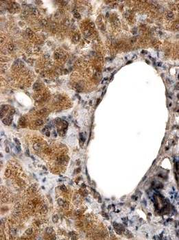 CCAR2/DBC1 Antibody