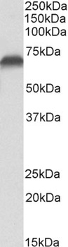 CCAR2/DBC1 Antibody