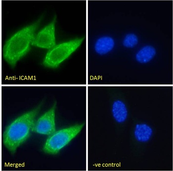 calbindin D28 Antibody