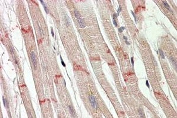 SLC2A4 Antibody