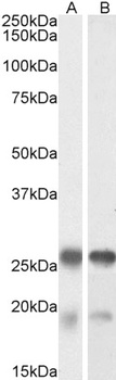 TIAL1 Antibody
