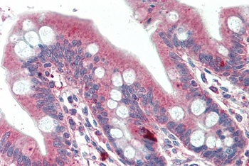 PRDM1 Antibody