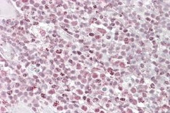 PRDM1 Antibody