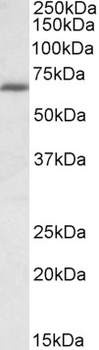 PRDM1 Antibody