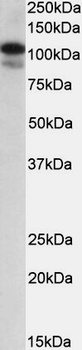 PRDM1 Antibody