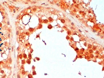UBE2R2 Antibody