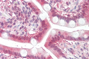 PSMB3 Antibody