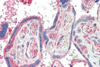 TXK Antibody