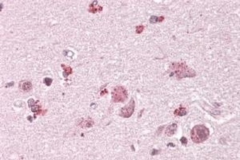 TXK Antibody