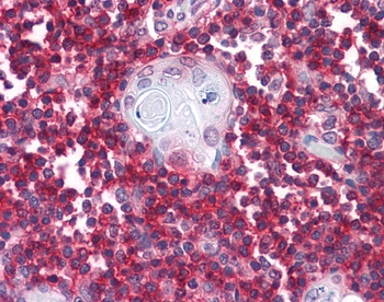 CD247 Antibody
