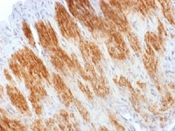 CNN1 Antibody