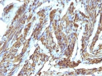 CNN1 Antibody