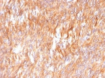 Calnexin Antibody [CANX/1541]