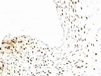 L1 Antibody
