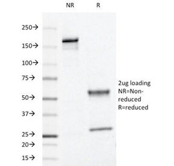 L1 Antibody