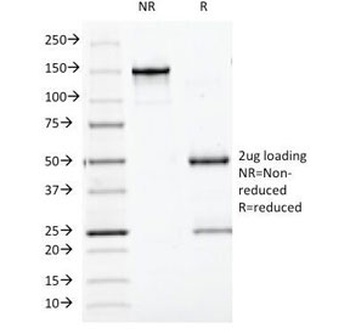 BCL10 Antibody