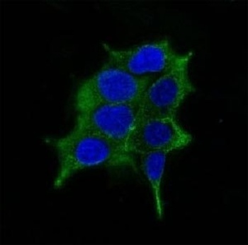 ODC1 Antibody