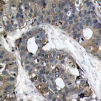 HSPB1 Antibody