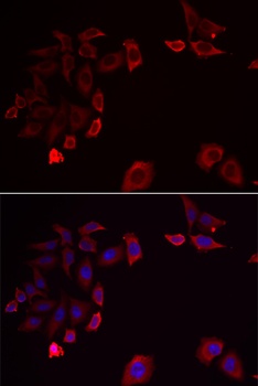 SKAP2 Antibody