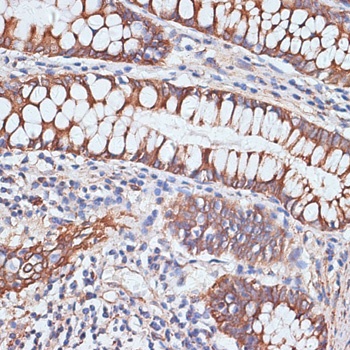 PIGR Antibody