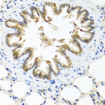 S100A7 Antibody