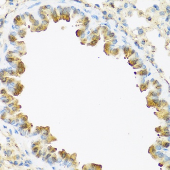 S100A7 Antibody