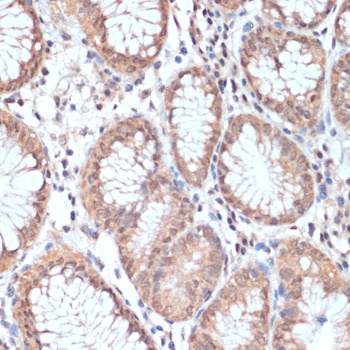 PRMT7 Antibody