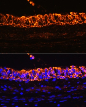 KRT7 Antibody