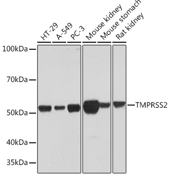 TMPRSS2 Antibody