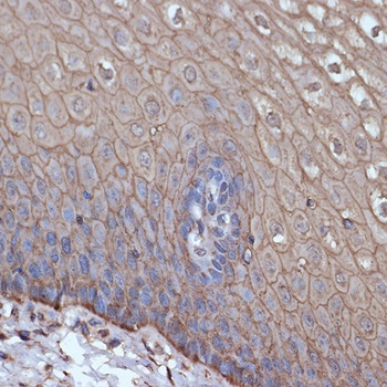 TMPRSS2 Antibody