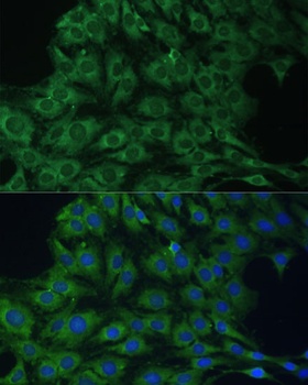 YTHDF1 Antibody