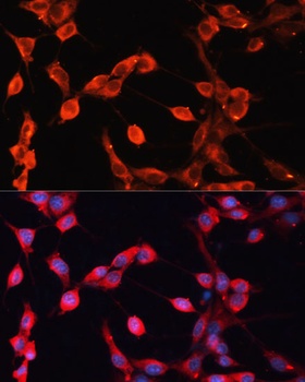 ADAMTS13 Antibody