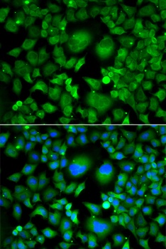 UBE2H Antibody