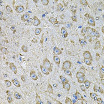 PDIA6 Antibody