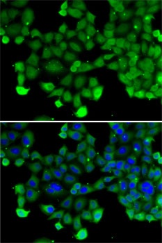 SNRPD2 Antibody